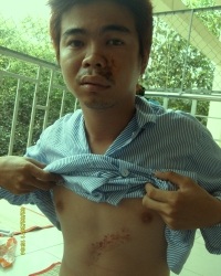 6 khách du lịch bị quây đánh dã man - 1 6 khách du lịch bị quây đánh dã man - 1