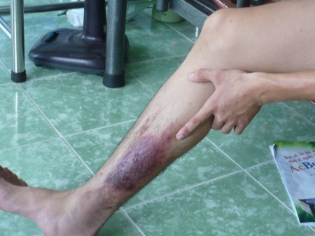 “Bệnh lạ” ở ĐH Cần Thơ: “Thủ phạm” là kiến ba khoang - 1