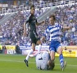 Petr Cech phải phẫu thuật vì vỡ xương sọ - 2