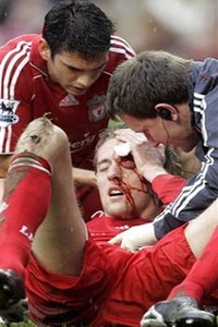 Cú đúp "ngã" của Gerrard và chiến thắng cho Liverpool - 2 Cú đúp "ngã" của Gerrard và chiến thắng cho Liverpool - 2