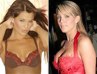 Bạn gái cũ Sheringham bơm ngực?  - 2