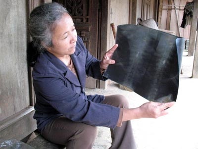 Cả xã bị “đầu độc” bệnh đau đầu, thấp khớp - 1 Cả xã bị “đầu độc” bệnh đau đầu, thấp khớp - 1