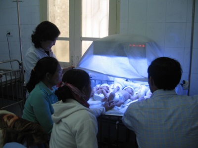 Trẻ vàng da tăng đột biến - 1 Trẻ vàng da tăng đột biến - 1