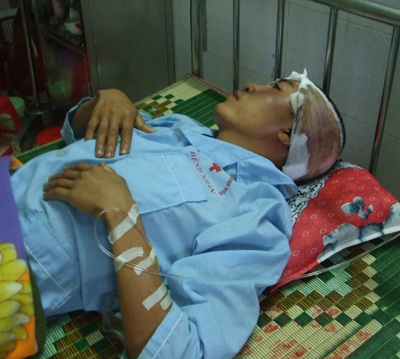 Cứu sống nạn nhân bị đánh vỡ hộp sọ - 1