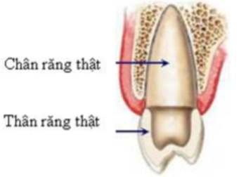 Hậu quả của mất răng và cách khắc phục - 2 Hậu quả của mất răng và cách khắc phục - 2