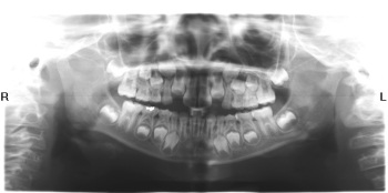 Sử dụng X-quang trong Nha khoa - 5