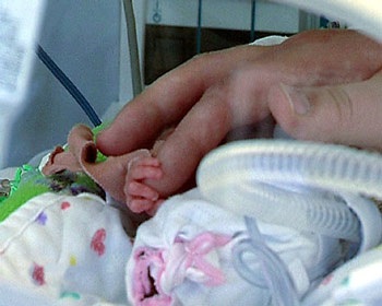 Một ca sinh năm hiếm gặp - 2 Một ca sinh năm hiếm gặp - 2