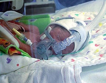 Một ca sinh năm hiếm gặp - 1 Một ca sinh năm hiếm gặp - 1