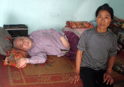 Một “ngõ khuyết tật” bị “lãng quên” - 3