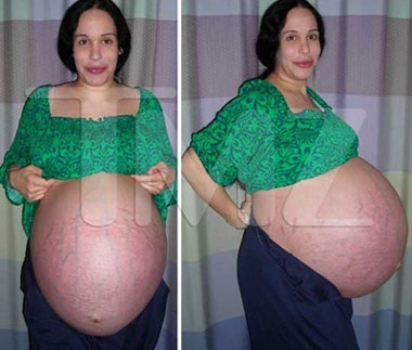 Những bức ảnh gây sốc về bụng bầu của bà mẹ sinh 8 - 1