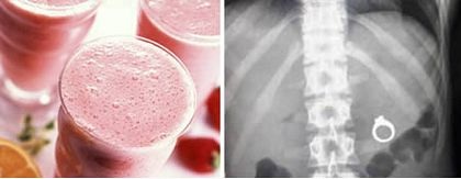 Những “tai nạn” cầu hôn nổi tiếng thế giới - 1