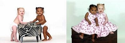 10 cặp song sinh kỳ lạ nhất thế giới - 1