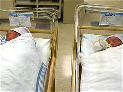 10 cặp song sinh kỳ lạ nhất thế giới - 3