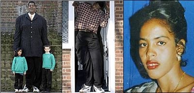 10 cặp song sinh kỳ lạ nhất thế giới - 6