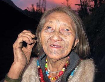 Nguy cơ “khai tử” của tục xăm mặt hình con bướm xanh  - 1