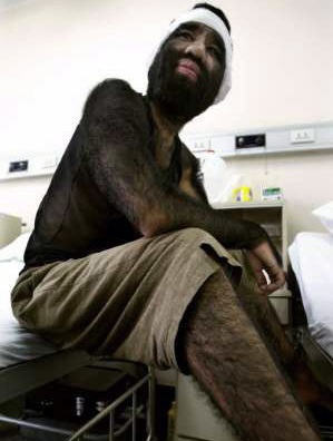 Gặp những người kỳ lạ trong sách kỷ lục Guinness (2) - 3