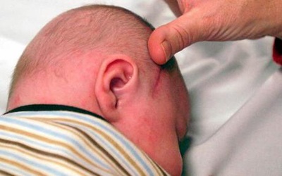 Phát hiện bàn chân trong não em bé 3 ngày tuổi - 2