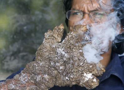 “Người cây” của Indonesia mọc rễ trở lại - 1