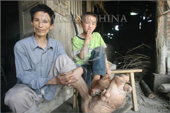 Người đàn ông có đôi chân khổng lồ - 1