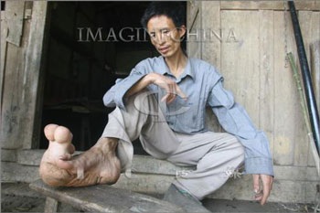 Người đàn ông có đôi chân khổng lồ - 6