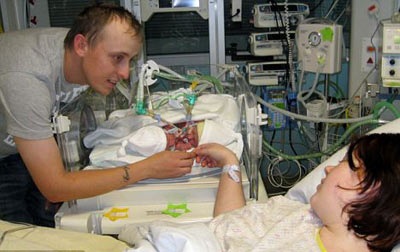 Tách cặp song sinh dính liền 1 tuần tuổi ở Anh - 2