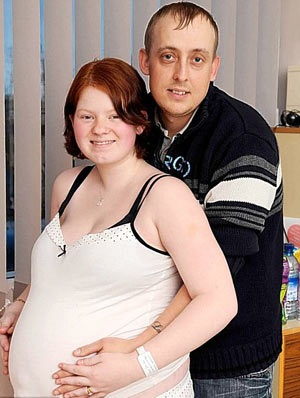 Tách cặp song sinh dính liền 1 tuần tuổi ở Anh - 3