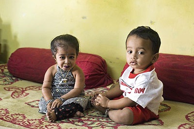 Bé gái nhỏ nhất thế giới - 2