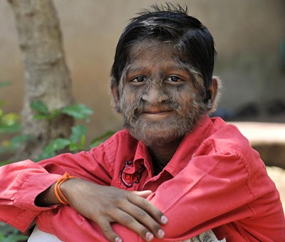 “Cậu bé ma sói” ở Ấn Độ - 10