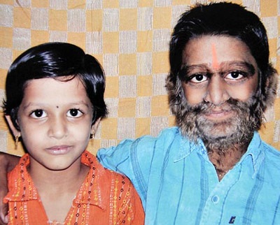 “Cậu bé ma sói” ở Ấn Độ - 11