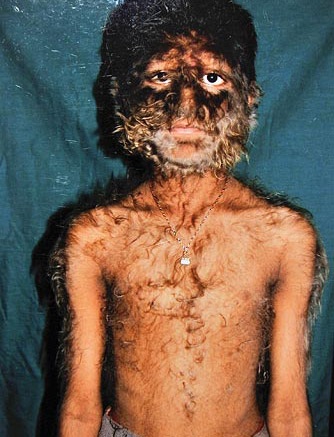 “Cậu bé ma sói” ở Ấn Độ - 2