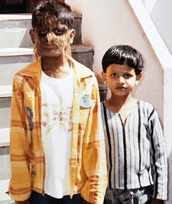 “Cậu bé ma sói” ở Ấn Độ - 12