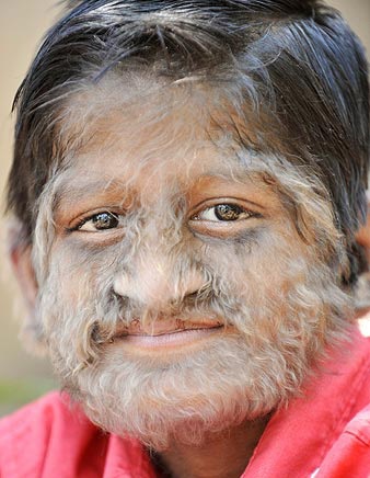 “Cậu bé ma sói” ở Ấn Độ - 1