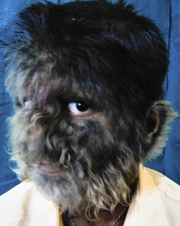 “Cậu bé ma sói” ở Ấn Độ - 8