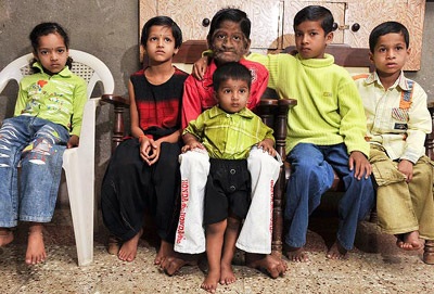 “Cậu bé ma sói” ở Ấn Độ - 5