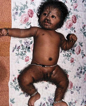 “Cậu bé ma sói” ở Ấn Độ - 3