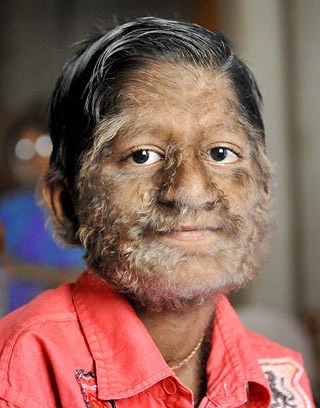 “Cậu bé ma sói” ở Ấn Độ - 7