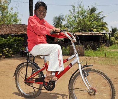 “Cậu bé ma sói” ở Ấn Độ - 9