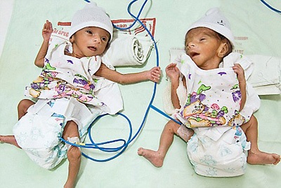 Một phụ nữ 70 tuổi sinh đôi - 1