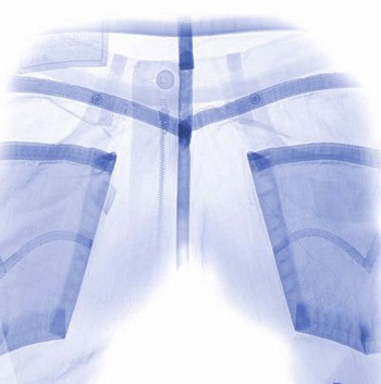 Những kiệt tác ảnh từ tia X-quang - 5