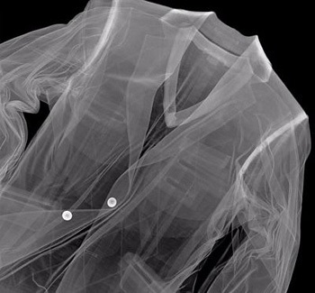 Những kiệt tác ảnh từ tia X-quang - 6