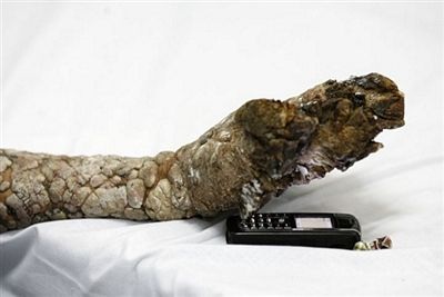 “Người cây” được tạm thời xuất viện - 5