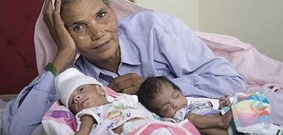 Những cặp song sinh kỳ lạ nhất trong lịch sử (1) - 2