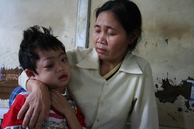 “Cháu không sợ đau, hãy giúp cháu!” - 1 “Cháu không sợ đau, hãy giúp cháu!” - 1