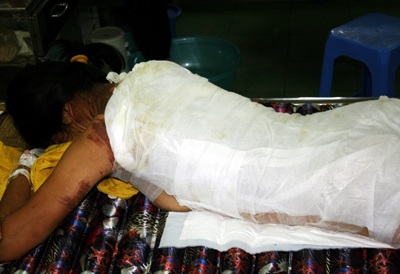 Cam chịu bị bạo hành vì thương con - 2 Cam chịu bị bạo hành vì thương con - 2