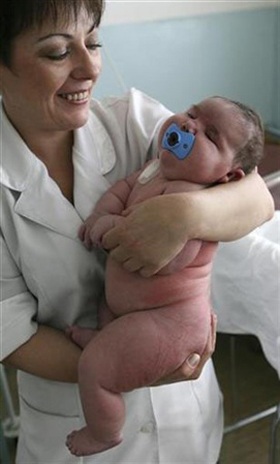 Em bé sơ sinh nặng nhất thế giới giờ ra sao? - 2