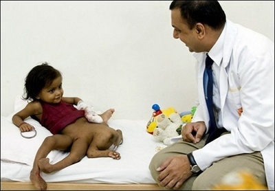 Ca phẫu thuật "thần tốc" cho bé gái 4 chân, 4 tay (kèm video) - 2 Ca phẫu thuật "thần tốc" cho bé gái 4 chân, 4 tay (kèm video) - 2