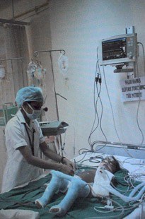 Ca phẫu thuật "thần tốc" cho bé gái 4 chân, 4 tay (kèm video) - 5 Ca phẫu thuật "thần tốc" cho bé gái 4 chân, 4 tay (kèm video) - 5