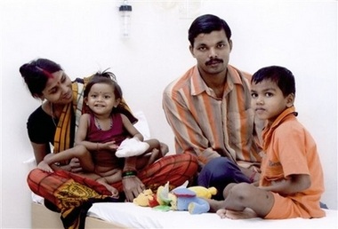 Ca phẫu thuật "thần tốc" cho bé gái 4 chân, 4 tay (kèm video) - 4 Ca phẫu thuật "thần tốc" cho bé gái 4 chân, 4 tay (kèm video) - 4