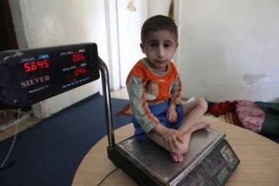 Chùm ảnh: Thăm cậu bé tí hon nhất thế giới - 2 Chùm ảnh: Thăm cậu bé tí hon nhất thế giới - 2