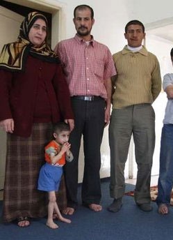 Chùm ảnh: Thăm cậu bé tí hon nhất thế giới - 6 Chùm ảnh: Thăm cậu bé tí hon nhất thế giới - 6